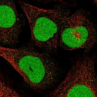 Click to enlarge image Results provided by the Human Protein Atlas (www.proteinatlas.org). The subcellular location is supported by literature. Immunofluorescent staining of human cell line U-2 OS shows localization to nucleoplasm. Human assay: A-431 fixed with PFA, dilution: 1:2000 Human assay: U-2 OS fixed with PFA, dilution: 1:2000 Human assay: U-251 MG fixed with PFA, dilution: 1:2000