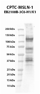 Click to enlarge image Western blot using CPTC-MSLN-1 as primary antibody against mesothelin (MSLN), transcript variant 1, transient overexpression lysate. The expected molecular weight is 67.9 kDa.