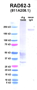 Click to enlarge image Western Blot using CPTC-RAD52-3 as primary Ab against PNMT (rAg 10468) in lane 2. Also included are molecular wt. standards (lane 1) and mouse IgG control (lane 3).