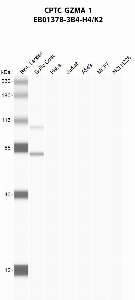 Click to enlarge image Automated western blot using CPTC-GZMA-1 as primary antibody against buffy coat (lane 2), HeLa (lane 3), Jurkat (lane 4), A549 (lane 5), MCF7 (lane 6), and H226 (lane 7) whole cell lysates.  Expected molecular weight - 29.0 kDa and 27.1 kDa.  Molecular weight standards are also included (lane 1).