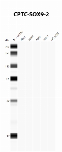 Click to enlarge image Automated Western Blot using CPTC-SOX9-2 as primary antibody against cell lysates A549, H226, HeLa, Jurkat and MCF7. Expected MW of 56.1 KDa. All cell lysates negative.  Molecular weight standards are also included (lane 1).