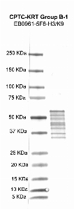 点击放大图像，使用CPTC-KRT B-1组作为重组人角蛋白8（KRT8）蛋白的主要抗体进行Western blot。还包括分子量标准。