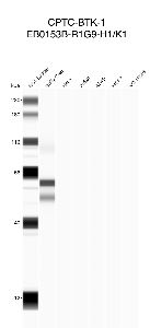 Click to enlarge image Automated western blot using CPTC-BTK-1 as primary antibody against buffy coat (lane 2), HeLa (lane 3), Jurkat (lane 4), A549 (lane 5), MCF7 (lane 6), and H226 (lane 7) whole cell lysates.  Expected molecular weight - 76.3 kDa and 79.9 kDa.  Molecular weight standards are also included (lane 1). Buffy coat is presumed positive. All other cell lines are negative.