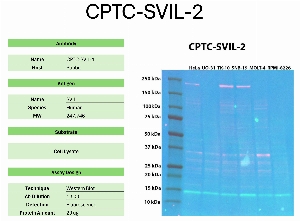 Click to enlarge image Western blot using CPTC-SVIL-2 as primary antibody against the whole lysates of HeLa, UO-31, TK-10, SNB-19, MOLT-4, and RPMI-8226. The antibody detected the target protein (~247.7 KDa) in HeLa, TK-10, and SNB-19 cell lysates.