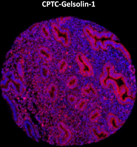 Click to enlarge image Imaging mass cytometry on normal endometrium tissue core using CPTC-Gelsolin-1 metal-labeled antibody.  Data shows an overlay of the target protein signal (red) and DNA (blue). Dilution: 1:100 of 0.5mg/mL stock. Signal was also obtained in other normal tissues (liver, bone marrow, spleen, placenta, prostate, colon, pancreas, breast, lung, testis, endometrium, appendix, and kidney) and cancer tissues (colon, breast, ovarian, lung, and prostate).