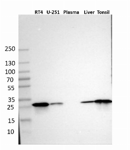 Click to enlarge image Results provided by the Human Protein Atlas (www.proteinatlas.org). Single band corresponding to the predicted size in kDa (+/-20%). Analysis performed using a standard panel of samples. Antibody dilution: 1:500