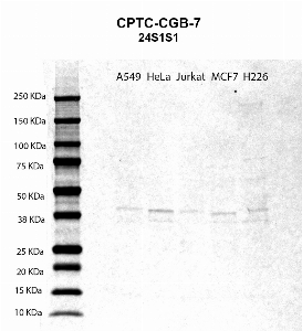 Click to enlarge image Western blot using CPTC-CGB-7 as primary antibody against A549 (lane 2), HeLa (lane 3), Jurkat (lane 4), MCF7 (lane 5), and H226 (lane 6) whole cell lysates.  Expected molecular weight - 17 kDa.  Molecular weight standards are also included (lane 1). Blot was developed using enhanced chemiluminescence (ECL).