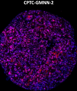 Click to enlarge image Imaging mass cytometry on normal lung tissue core using CPTC-GMNN-2 metal-labeled antibody.  Data shows an overlay of the target protein signal (red) and DNA (blue). Dilution: 1:100 of 0.5mg/mL stock. Signal was also obtained in other normal tissues (liver, bone marrow, spleen, placenta, prostate, colon, pancreas, breast, lung, testis, endometrium, appendix, and kidney) and cancer tissues (colon, breast, ovarian, lung, and prostate).