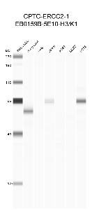 Click to enlarge image Automated western blot using CPTC-ERCC2-1 as primary antibody against buffy coat (lane 2), HeLa (lane 3), Jurkat (lane 4), A549 (lane 5), MCF7 (lane 6), and H226 (lane 7) cell lysates.  Expected molecular weight - 86.9 kDa.  Molecular weight standards are also included (lane 1). Inconclusive data.