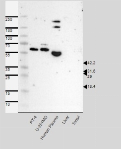 Click to enlarge image Results provided by the Human Protein Atlas (www.proteinatlas.org).


Band of predicted size in kDa (+/-20%) with additional bands present.
Analysis performed using a standard panel of samples. Antibody dilution: 1:500