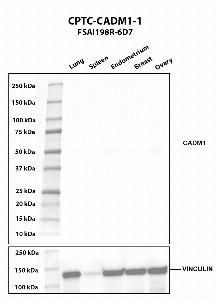 Click to enlarge image Western blot using CPTC-CADM1-1 as primary antibody against human lung (2), spleen (3), endometrium (4), breast (5), and ovary (6) tissue lysates. The expected molecular weight is 48.5 kDa, 36.9 kDa, 51.5 kDa, 49.6 kDa, and 45.6 kDa. Vinculin was used as a loading control.