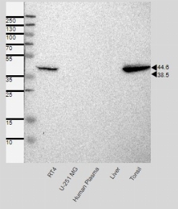 Click to enlarge image Results provided by the Human Protein Atlas (www.proteinatlas.org). Single band corresponding to the predicted size in kDa (+/-20%). Analysis performed using a standard panel of samples. Antibody dilution: 1:500.