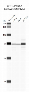 Click to enlarge image Western Blot using CPTC-PAK4-1 as primary antibody against cell lysates LCL57 (lane 2), HeLa (lane 3) and MCF10A (lane 4). Also included are molecular weight standards (lane 1).