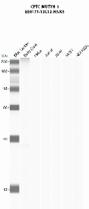 Click to enlarge image Automated western blot using CPTC-MUTYH-1 as primary antibody against buffy coat (lane 2), HeLa (lane 3), Jurkat (lane 4), A549 (lane 5), MCF7 (lane 6), and NCI-H226 (lane 7) whole cell lysates.  Expected molecular weight - 60.1 kDa, 59.1 kDa, 58.4 kDa, 57.5 kDa, and 57.4 kDa.  Molecular weight standards are also included (lane 1).