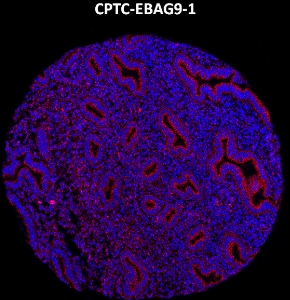 Click to enlarge image Imaging mass cytometry on normal endometrium tissue core using CPTC-EBAG9-1 metal-labeled antibody.  Data shows an overlay of the target protein signal (red) and DNA (blue). Dilution: 1:100 of 0.5mg/mL stock. Signal was also obtained in other normal tissues (liver, bone marrow, colon, pancreas, breast, lung, testis, endometrium, appendix, and kidneys) and cancer tissues (lung, breast, ovarian, and colon).