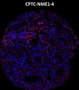 Click to enlarge image Imaging mass cytometry on normal testis tissue core using CPTC-NME1-4 metal-labeled antibody.  Data shows overlay of target protein signal (red) and DNA (blue). Dilution: 1:100 of 0.5mg/mL stock. Signal was also obtained in other normal tissues (testis, prostate, liver, colon, endometrium, appendix, pancreas, bone marrow, breast, kidney, lung, and placenta) and cancer tissues (breast, colon, prostate, lung, and ovarian).