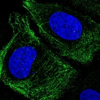 Click to enlarge image Results provided by the Human Protein Atlas (www.proteinatlas.org). The subcellular location is partly supported by literature or no literature is available. Immunofluorescent staining of human cell line U-2 OS shows localization to cytosol & actin filaments. Human assay: A-431 fixed with PFA, dilution: 1:50
Human assay: U-2 OS fixed with PFA, dilution: 1:50
Human assay: U-251 MG fixed with PFA, dilution: 1:50