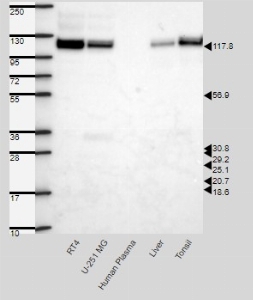 Click to enlarge image Results provided by the Human Protein Atlas (www.proteinatlas.org). Band of predicted size in kDa (+/-20%) with additional bands present. Analysis performed using a standard panel of samples. Antibody dilution: 1:500.