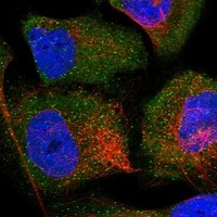 Click to enlarge image Results provided by the Human Protein Atlas (www.proteinatlas.org). The subcellular location is supported by literature. Immunofluorescent staining of human cell line U-2 OS shows localization to cytosol & vesicles. Human assay: A-431 fixed with PFA, dilution: 1:20
Human assay: U-2 OS fixed with PFA, dilution: 1:20
Human assay: U-251 MG fixed with PFA, dilution: 1:20