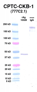 Click to enlarge image Western Blot using CPTC-CKB-1 as primary Ab against CKB (Ag 10328) (lane 2). Also included are molecular wt. standards (lane 1) and mouse IgG control (lane 3).