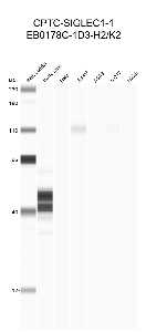 Click to enlarge image Automated western blot using CPTC-SIGLEC1-1 as primary antibody against buffy coat (lane 2), HeLa (lane 3), Jurkat (lane 4), A549 (lane 5), MCF7 (lane 6), and H226 (lane 7) cell lysates.  Expected molecular weight - 181 kDa.  Molecular weight standards are also included (lane 1). Data is negative/inconclusive.