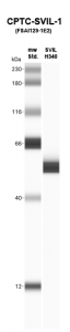 Click to enlarge image Western Blot using CPTC-SVIL-1 as primary Ab against Supervillin H340 (rAg 00259) (lane 2). Also included are molecular wt. standards (lane 1)