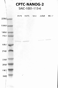 Click to enlarge image Western Blot using CPTC-NANOG-2 as primary antibody against cell lysates A549, H226, HeLa, Jurkat and MCF7. Expected MW of 34.6 KDa. Presumed positive for A549, H226, Jurkat and MCF7. Negative for HeLa.  Molecular weight standards are also included (lane 1).
