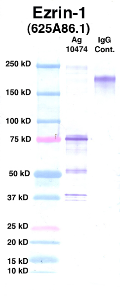 Click to enlarge image Western Blot using CPTC-Erzin-1 as primary Ab against Ag 10474 (lane 2). Also included are molecular wt. standards (lane 1) and mouse IgG control (lane 3).