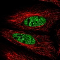 Click to enlarge image Results provided by the Human Protein Atlas (www.proteinatlas.org). The subcellular location is supported by literature. Immunofluorescent staining of human cell line HeLa shows localization to nucleoplasm & nuclear bodies. Human assay: HeLa fixed with PFA, dilution: 1:2000
Human assay: MCF7 fixed with PFA, dilution: 1:2000
Human assay: U-2 OS fixed with PFA, dilution: 1:2000