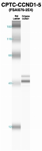 Click to enlarge image Western Blot using CPTC-CCND1-5 as primary Ab against CCND1 (lane 2). Also included are molecular wt. standards (lane 1).