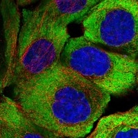 Click to enlarge image Results provided by the Human Protein Atlas (www.proteinatlas.org). The subcellular location is supported by literature. Immunofluorescent staining of human cell line A-431 shows localization to cytosol. Human assay: A-431 fixed with PFA, dilution: 1:100
Human assay: U-2 OS fixed with PFA, dilution: 1:100
Human assay: U-251 MG fixed with PFA, dilution: 1:100