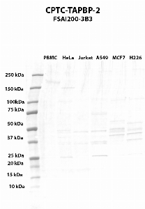 Click to enlarge image Western blot using CPTC-TAPBP-2 as primary antibody against PBMC (lane 2), HeLa (lane 3), Jurkat (lane 4), A549 (lane 5), MCF7 (lane 6), and NCI-H226 (lane 7) whole cell lysates.  Expected molecular weight - 47.6 kDa, 43.9 kDa, 53.9 kDa, and 38.4 kDa.  Molecular weight standards are also included (lane 1).