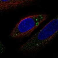 Click to enlarge image Results provided by the Human Protein Atlas (www.proteinatlas.org). The subcellular location is supported by literature. Immunofluorescent staining of human cell line U2OS shows localization to lipid droplets. Human assay: THP-1 fixed with PFA, dilution: 1:100 Human assay: U2OS fixed with PFA, dilution: 1:100