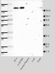 Click to enlarge image Results provided by the Human Protein Atlas (www.proteinatlas.org).


Single band corresponding to the predicted size in kDa (+/-20%).
Analysis performed using a standard panel of samples. Antibody dilution: 1:500