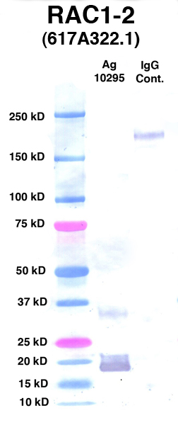 Click to enlarge image Western Blot Using CPTC-RAC1-2 as primary Ab against Ag 10295(Lane 2). Also included are Molecular Weight markers (Lane 1) and mouse IgG positive control (Lane 3).