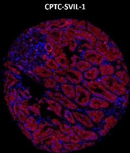 Click to enlarge image Imaging mass cytometry on normal kidney tissue core using CPTC-SVIL-1 metal-labeled antibody.  Data shows an overlay of the target protein signal (red) and DNA (blue). Dilution: 1:100 of 0.5mg/mL stock. Signal was also obtained in other normal tissues (testis, prostate, liver, colon, pancreas, bone marrow, breast, kidney, lung, and placenta) and cancer tissues (breast, colon, prostate, lung, and ovarian).