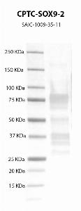 Click to enlarge image Western Blot using CPTC-SOX9-2 as primary antibody against recombinant SOX9 protein  (lane 2) with expected MW of 56 KDa. Molecular weight standards are also included (lane 1).