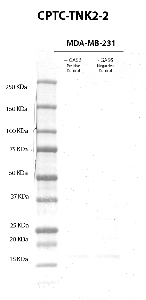 Click to enlarge image Western Blot usign CPTC-TNK2-2 as primary antibody against cell lysates of MDA-MB-231 cells treated (lane 2) and not treated (lane 3) with EGF (100 ng/mL0 for 10 minutes, after overnight starvation). Molecular weight standards are also included (lane 1). The antibody was not able to detect  the not phosphorylated and/or phosphrylated target protein in the EGF treated and not treated cell lysate. Expected molecultar weight for TNK2 is about 114 KDa.
