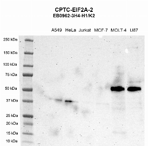 Click to enlarge image Western Blot using CPTC-EIF2A-2 as primary antibody against cell lysates A549 (lane 2), HeLa (lane 3), Jurkat (lane 4), MCF-7 (lane 5), MOLT-4 (lane 6), and U87 (lane 7). Molecular weight standards are also included (lane 1). HeLa, MOLT-4, and U87 are positive. A549, Jurkat, and MCF-7 are weak positive. Expected molecular weight – 64.9 kDa, 41.3 kDa, 62.3 kDa, and 57.9 kDa.