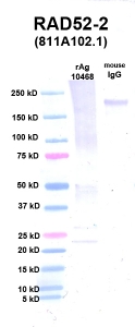 Click to enlarge image Western Blot using CPTC-RAD52-2 as primary Ab against PNMT (rAg 10468) in lane 2. Also included are molecular wt. standards (lane 1) and mouse IgG control (lane 3).