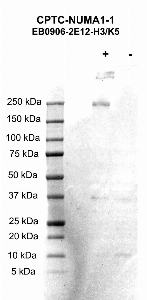 Click to enlarge image Western blot using CPTC-NUMA1-1 as primary antibody against LCL57 cell lysate.  Cell lysate was irradiated with 10 Gy as shown in the ‘+’ indicated lane.  Non-irradiated cell lysate was treated with alkaline phosphatase enzyme as shown in the ‘-‘ indicated lane.  Molecular weight standards are also included. Western blot was developed using enhanced chemiluminescence.