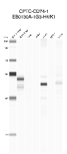 Click to enlarge image Automated western blot using CPTC-CD74-1 as primary antibody against buffy coat (lane 2), HeLa (lane 3), Jurkat (lane 4), A549 (lane 5), MCF7 (lane 6), and H226 (lane 7) cell lysates.  Expected molecular weight - 33.3 kDa.  Molecular weight standards are also included (lane 1). Inconclusive data.