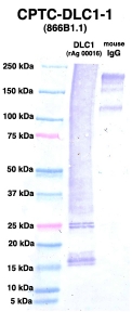 Click to enlarge image Western Blot using CPTC-DLC1-1 as primary Ab against DLC1 (rAg 00016) (lane 2). Also included are molecular wt. standards (lane 1) and mouse IgG control (lane 3).