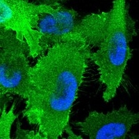 Click to enlarge image Results provided by the Human Protein Atlas (www.proteinatlas.org). The subcellular location is supported by literature. Immunofluorescent staining of human cell line U-251 MG shows localization to nucleoplasm, plasma membrane & cytosol. Human assay: U-2 OS fixed with PFA, dilution: 1:2500
Human assay: U-251 MG fixed with PFA, dilution: 1:2500.