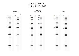 Click to enlarge image Automated western blot using CPTC-LIME1-1 as primary antibody against cell lysates HeLa, MCF10A, and LCL57.  Samples from each cell line were irradiated with 10 Gy as shown in ‘+’ indicated lanes. Samples from each non-irradiated cell line were treated with alkaline phosphatase enzyme as shown in ‘-‘ indicated lanes.  Molecular weight standards are included for each cell line.