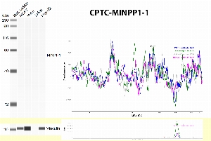 Click to enlarge image Negative
Automated western blot using CPTC-MINPP1-1 antibody against cell lysates of MCF7, HeLa, Jurkat and HepG2. The antibody is not able to detect the target in the tested cell lines. The same cell lines have been tested for Vinculin as loading control.