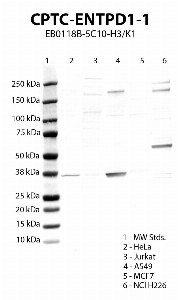 Click to enlarge image Western blot using CPTC-ENTPD1-1 as primary antibody against HeLa (lane 2), Jurkat (lane 3), A549 (lane 4), MCF7 (lane 5) and NCI H226 (lane 6) cell lysates.  Expected molecular weight 58 kDa.  Molecular weight standards (MW Stds.) are also included (lane 1).  Positive for cell line NCI H226.  Negative/ inconclusive data for the other cell lines.