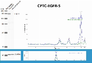 Click to enlarge image SW using CPTC-EGFR-5 as primary antibody against the whole lysates of WT HeLa and correpondent EGFR KO HeLa. The antibody is able to recognize the endogenous protein only in WT HeLa as expected.