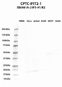 Click to enlarge image Western blot using CPTC-IFIT2-1 as primary antibody against PBMC (lane 2), HeLa (lane 3), Jurkat (lane 4), A549 (lane 5), MCF7 (lane 6), and NCI-H226 (lane 7) whole cell lysates.  Expected molecular weight - 54.6 kDa.  Molecular weight standards are also included (lane 1).