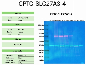 Click to enlarge image Western blot using CPTC-SLC27A3-4 as primary antibody against the whole lysates of U-87, MALME-3M, UACC-257, SK-MEL-28, MCF7, CCRF-CEM, and OVCAR-8. The antibody detected the target protein (~73.5 KDa) in MALME-3M, UACC-257, SK-MEL-28, and MCF7 cell lysates.
